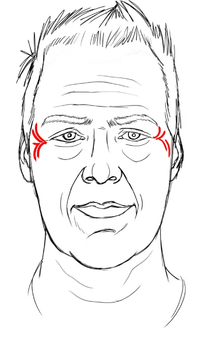 crow's feet on a middle-aged man