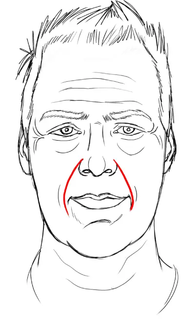 drawing nasolabial folds, middle-aged man