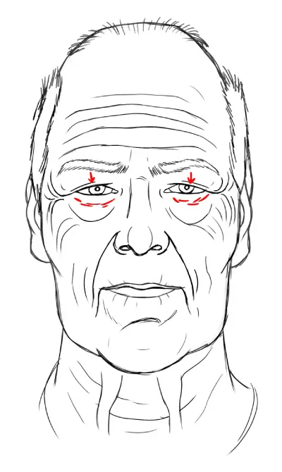 drawing smaller eyes on very old men